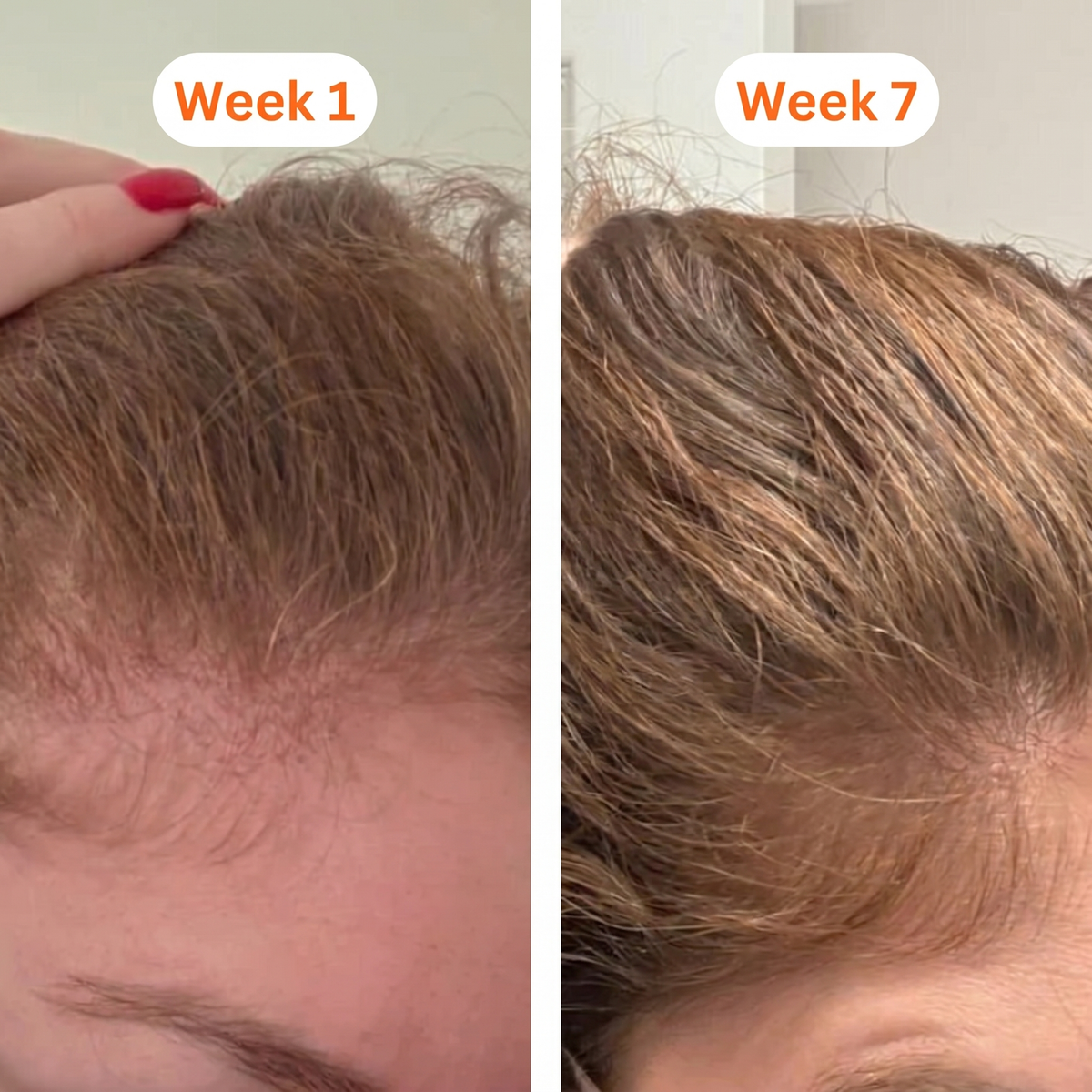 Postpartum Shedding transformation