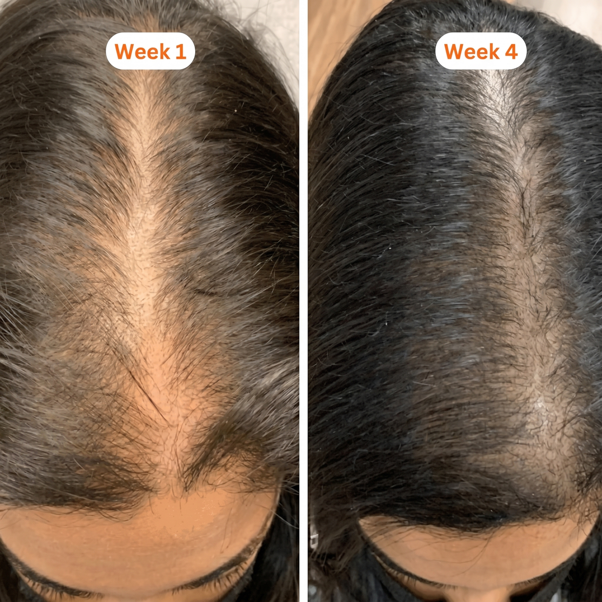 Stress Shedding transformation