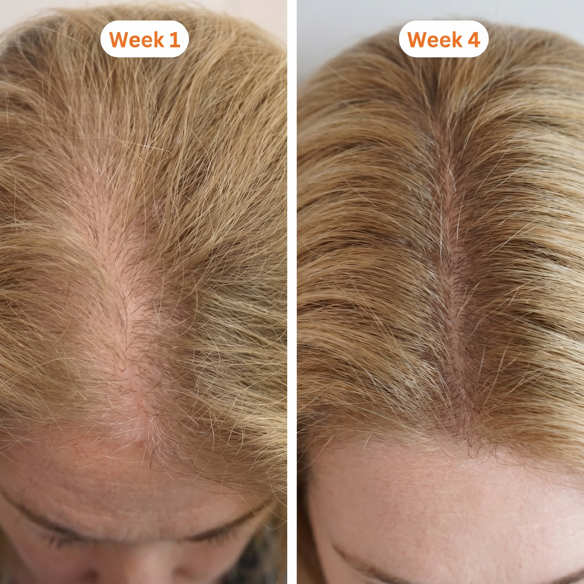 Thinning Crown transformation